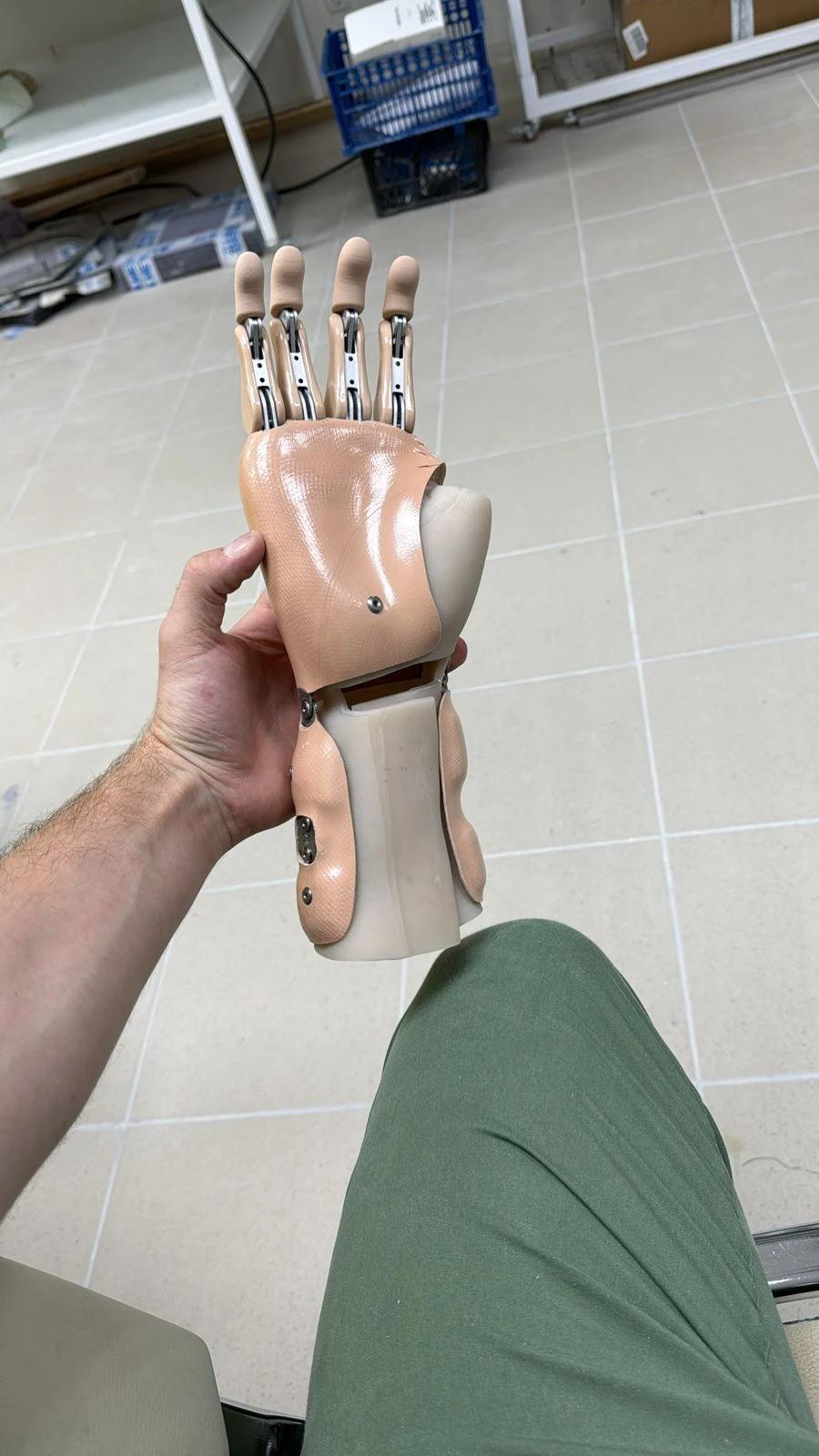 Active (traction) prosthesis of the hand, including for separation and partial separation of the hand