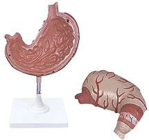 Anatomical model of stomach, item 12002-1