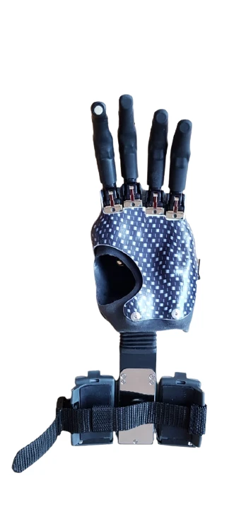 Hand prosthesis with external energy source PR0-MBO