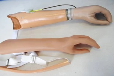 Active (traction) forearm prosthesis
