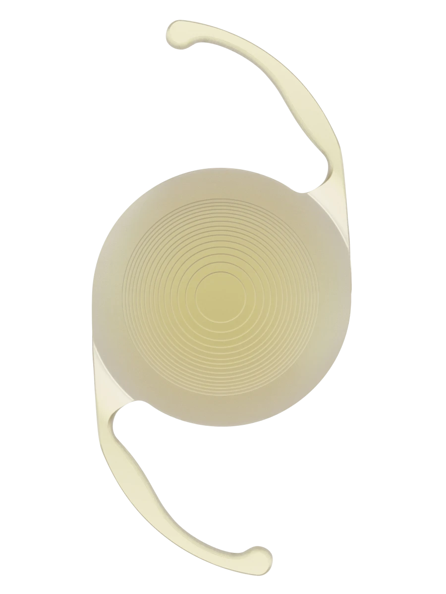 Intraocular lens soft posterior chamber.