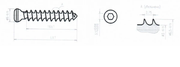Spongy titanium alloy solid thread screw 6.5mm 55mm