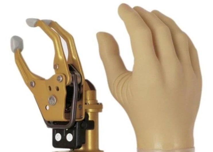 Hand prosthesis with external source of energy, including separation and partial separation of the hand PR0-23B1