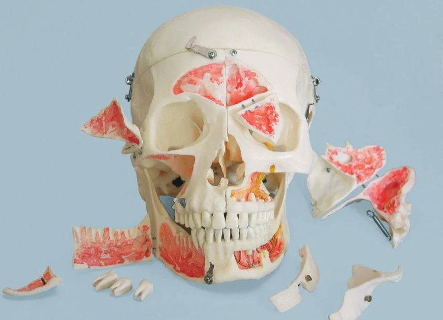 Collapsible colour skull model (16 parts), 11117-1