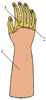 Cosmetic hand prosthesis, including partial and partial dislocation of the hand PR0-03