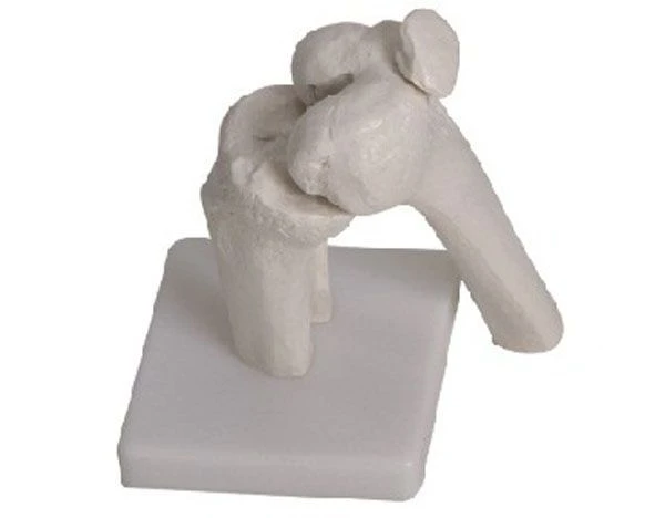 Bones of the knee joint, item 11201-5