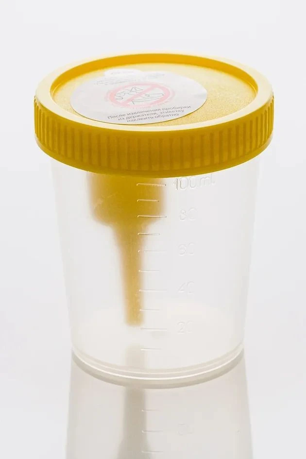 Disposable medical polymer sterile 100 ml container with built-in holder for vacuum tube with screw-on lid