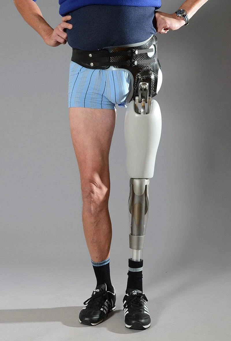 Modular microprocessor-controlled hip dislocation prosthesis