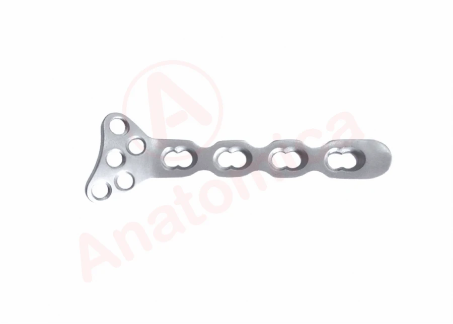 Plate for distal radius with angular stability.