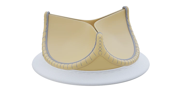 Xenopericardial biological canned heart valve prosthesis mounted on flexible support frame "UniLine" according to TU 9444-01-01-