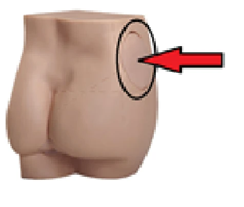 Insert for dummy KAR/T1