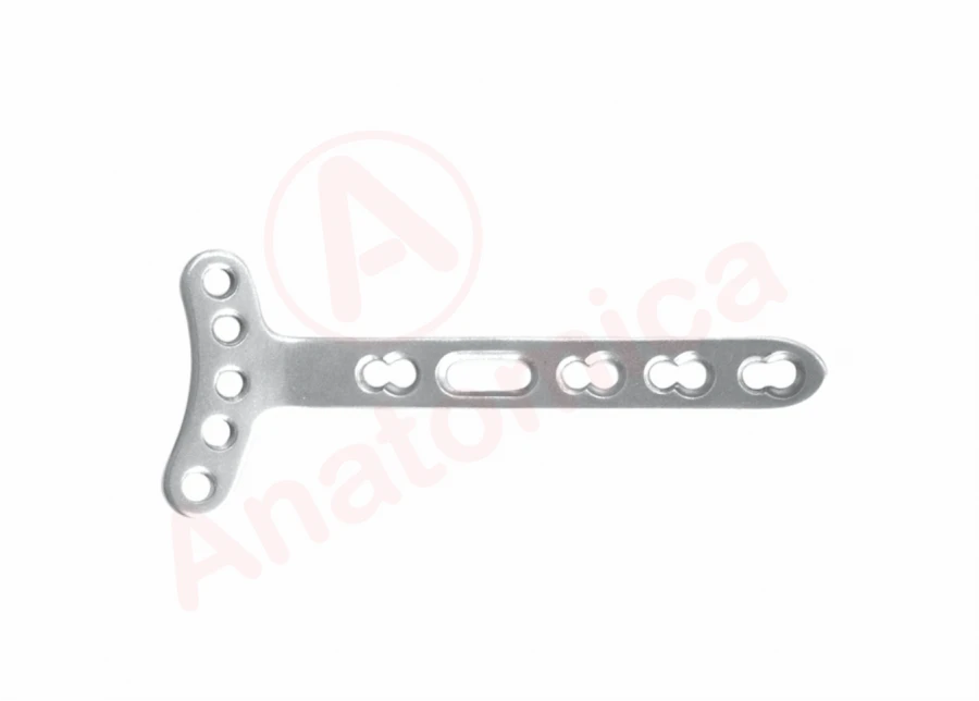 T-plate with angular stability with limited contact