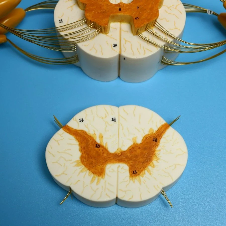 Model of enlarged spinal cord and spinal nerve branches, 18103