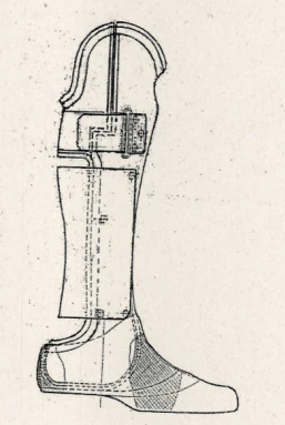 Foot prosthesis by Shopar (Lisfranc) PN0-06-02