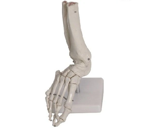 Bones of the foot, item 11201-6