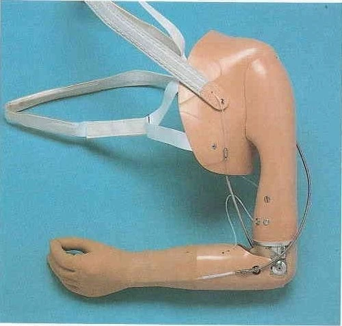 Prosthesis after shoulder dislocation with electromechanical actuator and contact control system PV-HFM