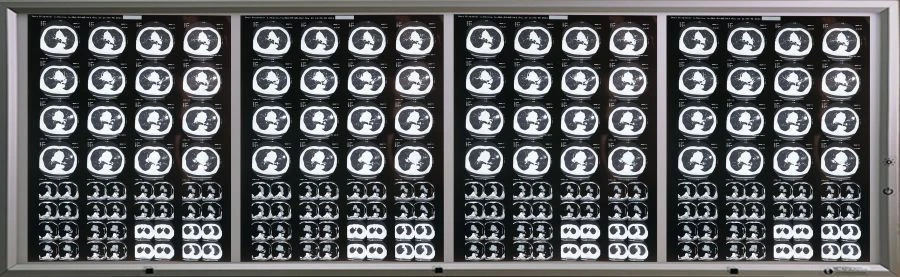 Medical Negatoscope according to TU 9452-001-11349579-2016 in variant version: Four-frame Negatoscope with accessories