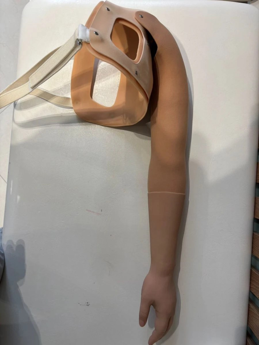 Cosmetic prosthesis after shoulder dislocation