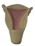 Intrauterine contraceptive device, B4