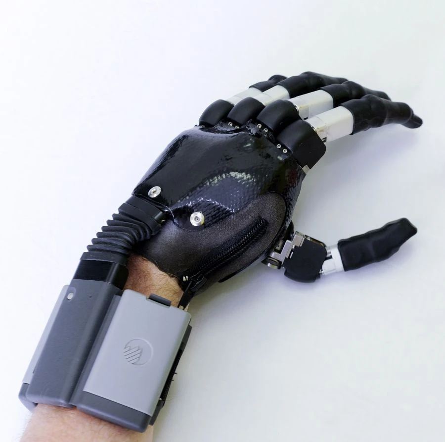 Microprocessor-controlled wrist prosthesis, including separation and partial separation of the hand.