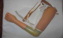 Active shoulder prosthesis