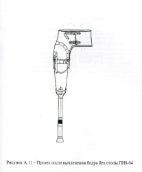 Hip disarticulation prosthesis with leather splint PN8-04