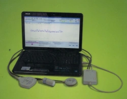 Obstetric computer monitor MAK-02-"Ch"
