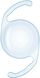 Intraocular polymer bifocal lens MIOL-ACORD