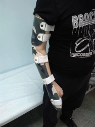 Orthopaedic devices for wrist and elbow joints