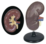 Enlarged kidney (3:1), U4005 / 14005