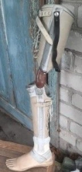 Non-modular tibial prosthesis
