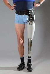 Modular microprocessor-controlled hip dislocation prosthesis