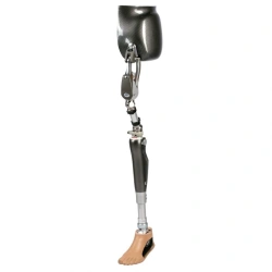 8-07-11 Modular hip replacement for femur dislocation PN8-13
