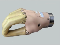 Active (traction) prosthesis of the hand, including for dislocation and partial dislocation of the hand PV-CT
