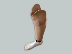 Modular tibial prosthesis, including for underdevelopment PN-G