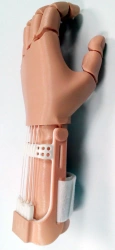 Active (traction) prosthesis of the hand, including separation and partial separation of the hand PR0-A.1