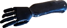 Forearm prosthesis with microprocessor control