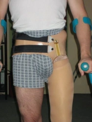 Modular prosthesis for hip dislocation