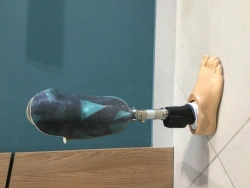 Tibia prosthesis with microprocessor control