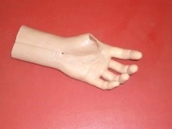 Cosmetic wrist prosthesis, including partial dislocation and partial dislocation of the hand PV-KKC