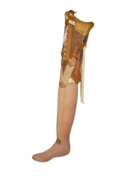 Hip replacement non-modular PN8-M-N