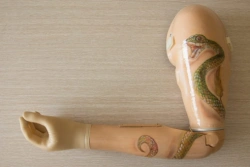Shoulder prosthesis with external power source