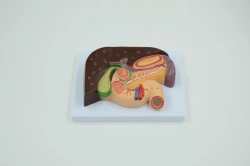 Model of liver, gall bladder, pancreas and duodenum, 3 parts, 11308-2