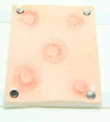 Modules of skin diseases (5 pcs), art. no. ROST-MKZ-5