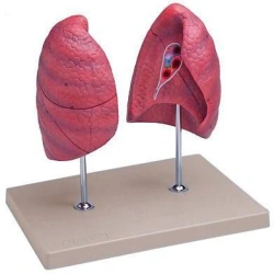 Lung model ( left and right), R3010