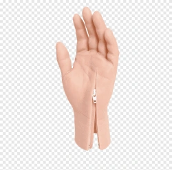 Cosmetic prosthesis of the hand, including partial and partial dislocation of the hand