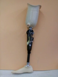 Modular hip prosthesis, including those with underdevelopment