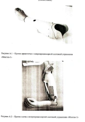 Shoulder prosthesis with external energy source PR4-B1 (with microprocessor control system "Myotea-1")