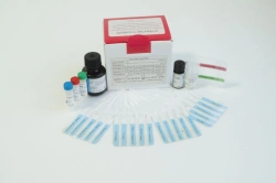Reagent kit for qualitative determination of allergen-specific antibodies in human serum, plasma and/or whole blood for