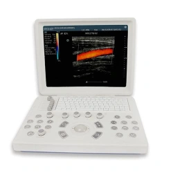 Optima-DK colour ultrasound machine
